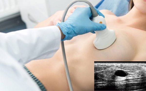Ultrassonografia pélvica